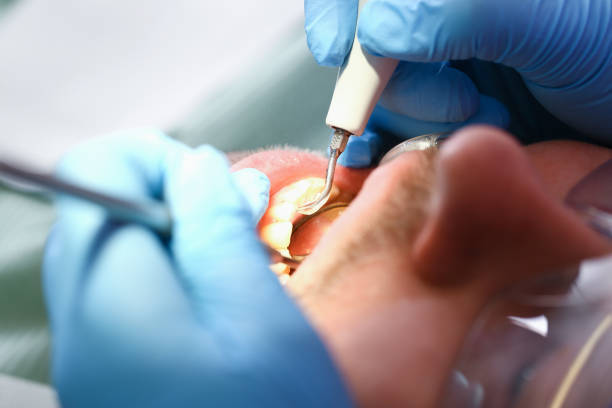 Best Emergency Dental Care for Broken or Chipped Teeth in Paulden, AZ